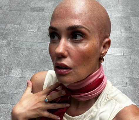 Агата Муцениеце испугала поклонников лысой головой Агата Муцениеце испугала поклонников лысой головой