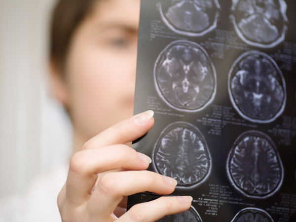 Специалисты Университета имени Вагнера научились лучше диагностировать рак мозга