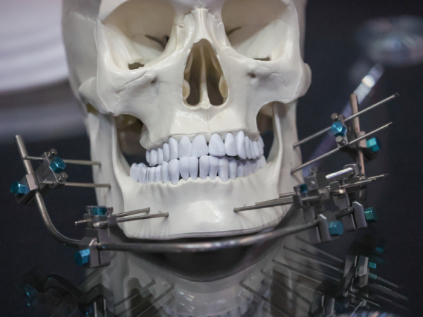 Врач объяснила, может ли ношение брекетов состарить лицо человека