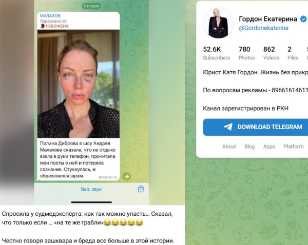 Екатерина Гордон прокомментировала синяки на лице жены Дмитрия Диброва Екатерина Гордон прокомментировала синяки на лице жены Дмитрия Диброва