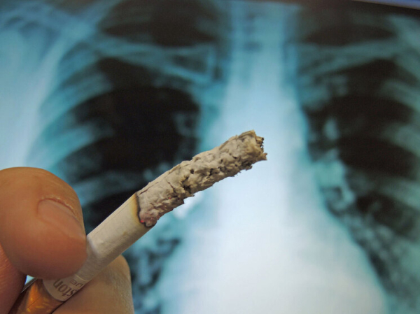 Научное сообщество ставит под сомнение роль стресса в развитии рака